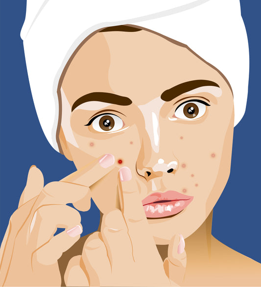 how to treat acne